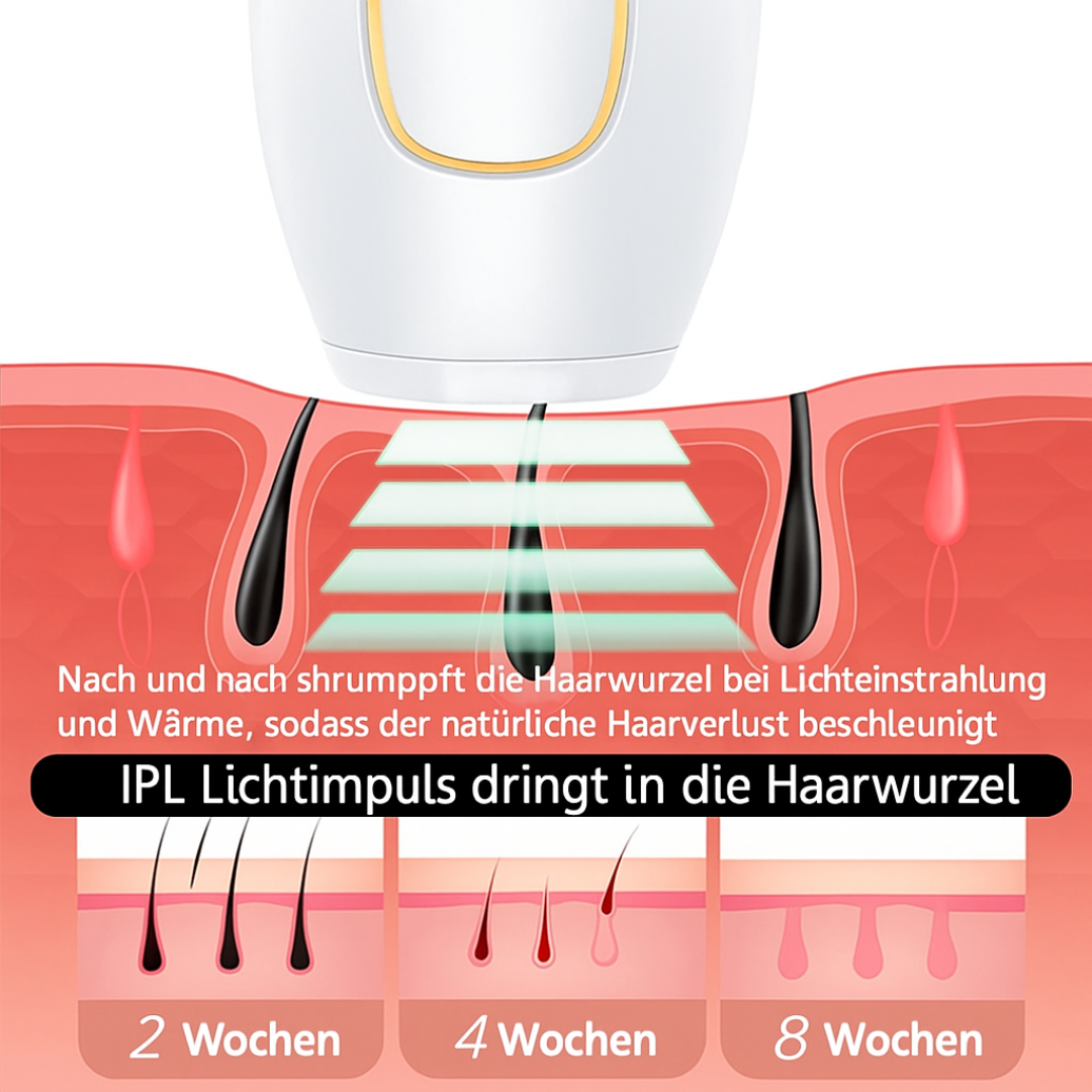 IPL Haarentfernung Gerät – Laser-Depilator für zuhause – Dauerhafte & schmerzfreie Haarentfernung für glatte Haut - Effektive IPL-Behandlung für Beine, Achseln, Arme & Intimbereich