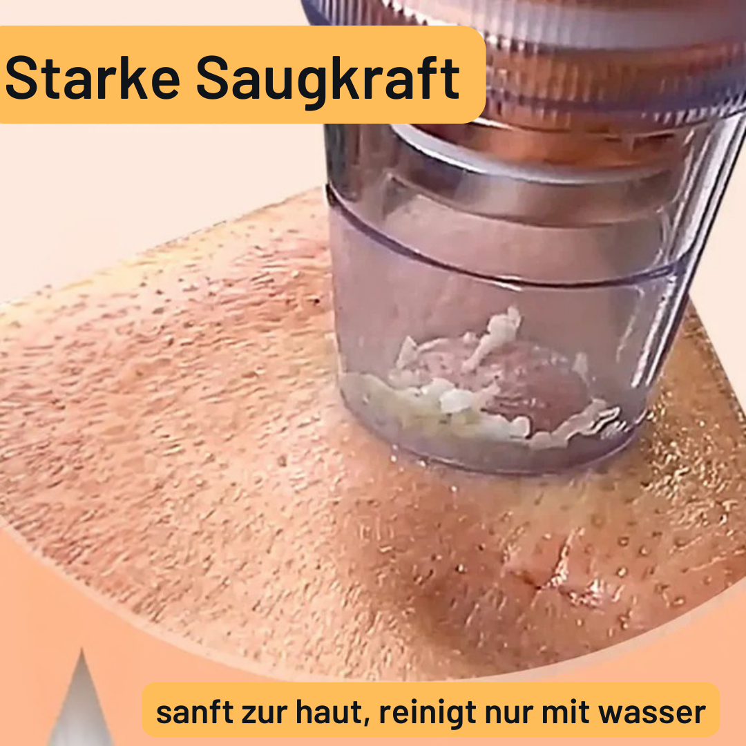 Mitessersauger Aqua Peeling Gerät – Hydra-Dermabrasion mit Sauerstoffzufuhr – Professionelle Reinigung für zuhause