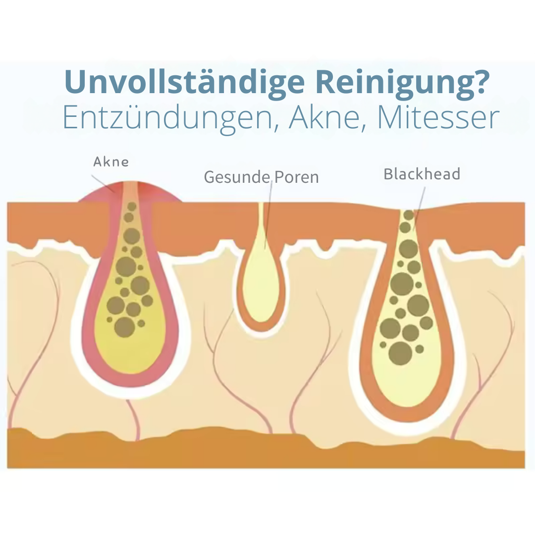 Mitessersauger Aqua Peeling Gerät – Hydra-Dermabrasion mit Sauerstoffzufuhr – Professionelle Reinigung für zuhause