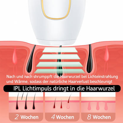 IPL Haarentfernung Gerät – Laser-Depilator für zuhause – Dauerhafte & schmerzfreie Haarentfernung für glatte Haut - Effektive IPL-Behandlung für Beine, Achseln, Arme & Intimbereich