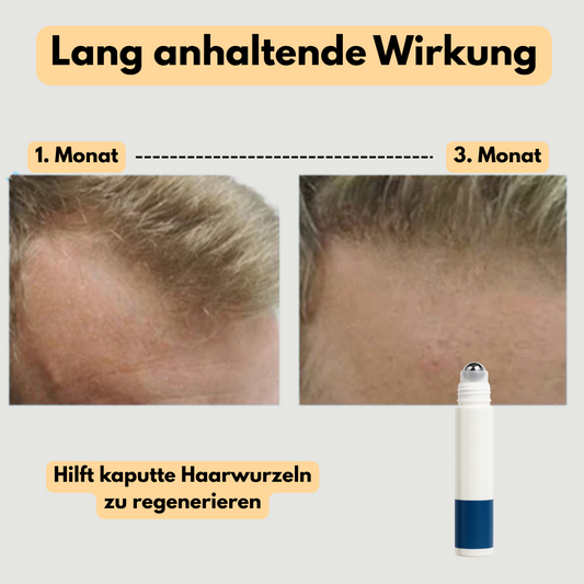 Haarwachstums_Rollerball