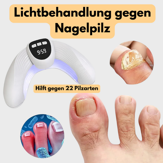 Nagelpilzbehandlung